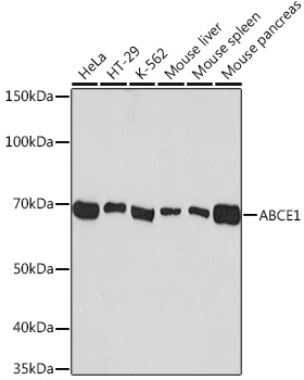 ABCE1 Monoclonal Antibody&nbsp;<img src="images/icon_newarrival.gif" alt="new" border="0">