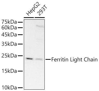 Ferritin Light Chain Monoclonal Antibody&nbsp;<img src="images/icon_newarrival.gif" alt="new" border="0">