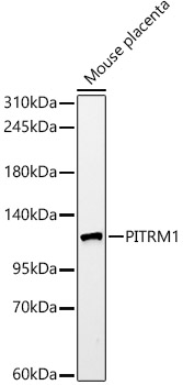 PITRM1 Monoclonal Antibody&nbsp;<img src="images/icon_newarrival.gif" alt="new" border="0">