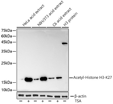 Acetyl-Histone H3-K27 Monoclonal Antibody&nbsp;<img src="images/icon_newarrival.gif" alt="new" border="0">