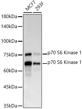 p70 S6 Kinase 1 Monoclonal Antibody&nbsp;<img src="images/icon_newarrival.gif" alt="new" border="0">