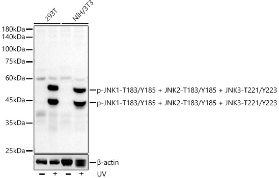 Phospho-JNK1-T183/Y185 + JNK2-T183/Y185 + JNK3-T221/Y223 Monoclonal Antibody&nbsp;<img src="images/icon_newarrival.gif" alt="new" border="0">