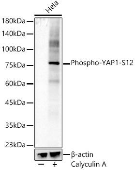 Phospho-YAP1-S127 Monoclonal Antibody&nbsp;<img src="images/icon_newarrival.gif" alt="new" border="0">