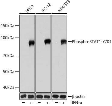 Phospho-STAT1-Y701 Monoclonal Antibody&nbsp;<img src="images/icon_newarrival.gif" alt="new" border="0">