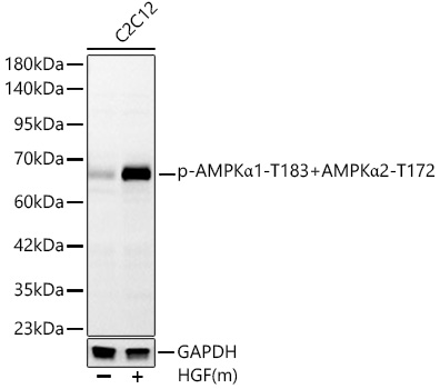 Phospho-AMPKa1-T183+AMPKa2-T172 Monoclonal Antibody&nbsp;<img src="images/icon_newarrival.gif" alt="new" border="0">