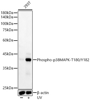 Phospho-p38 MAPK-T180/Y182 Monoclonal Antibody&nbsp;<img src="images/icon_newarrival.gif" alt="new" border="0">