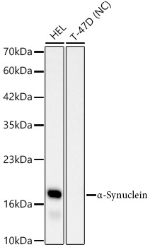 a-Synuclein Monoclonal Antibody&nbsp;<img src="images/icon_newarrival.gif" alt="new" border="0">