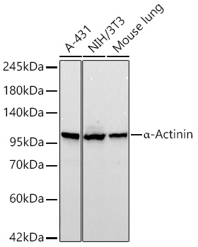 a-Actinin Monoclonal Antibody&nbsp;<img src="images/icon_newarrival.gif" alt="new" border="0">