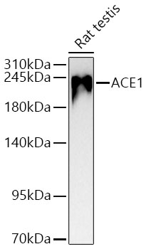 ACE1 Monoclonal Antibody&nbsp;<img src="images/icon_newarrival.gif" alt="new" border="0">