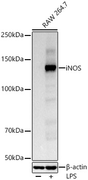 iNOS Monoclonal Antibody&nbsp;<img src="images/icon_newarrival.gif" alt="new" border="0">