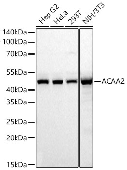 ACAA2 Monoclonal Antibody&nbsp;<img src="images/icon_newarrival.gif" alt="new" border="0">