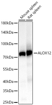 12 Lipoxygenase/ALOX12 Monoclonal Antibody&nbsp;<img src="images/icon_newarrival.gif" alt="new" border="0">