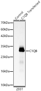 C1QB Polyclonal Antibody