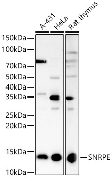 SNRPE Polyclonal Antibody