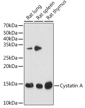 Cystatin A Monoclonal Antibody [9E2D7]