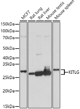 KITLG Polyclonal Antibody