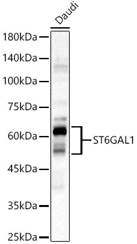 ST6GAL1 Polyclonal Antibody