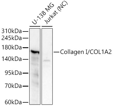 Collagen I/COL1A2 Polyclonal Antibody