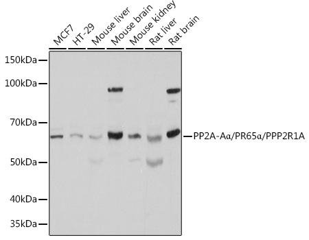 PP2A-Aa/PR65a/PPP2R1A Polyclonal Antibody