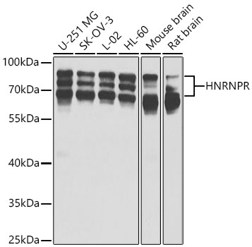 HNRNPR Polyclonal Antibody