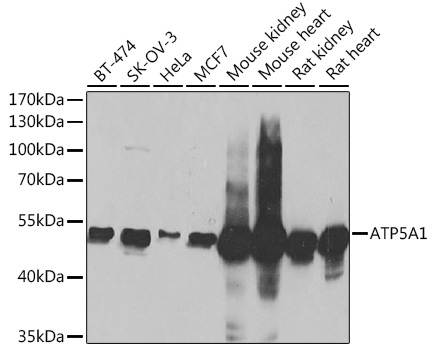 ATP5A1 Polyclonal Antibody