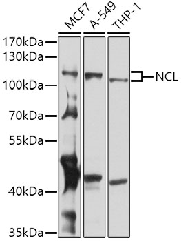 NCL Polyclonal Antibody