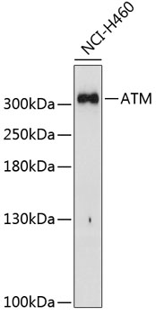 ATM Polyclonal Antibody