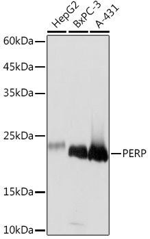 PERP Monoclonal Antibody [1O3L5]