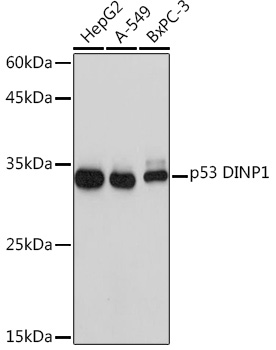 p53 DINP1 Monoclonal Antibody [9Y6Z7]