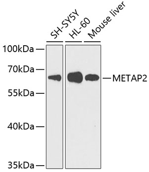 METAP2 Polyclonal Antibody