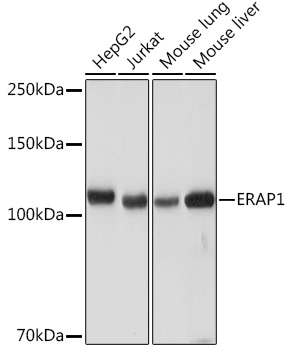 ERAP1 Monoclonal Antibody [6V8C0]