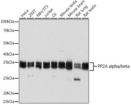 PP2A alpha/beta Monoclonal Antibody [4J2Z8]