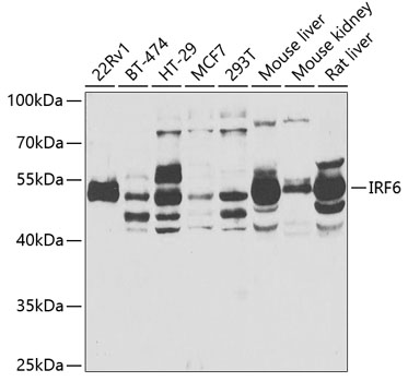 IRF6 Polyclonal Antibody