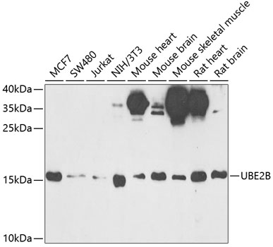 UBE2B Polyclonal Antibody