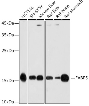 FABP5 Polyclonal Antibody