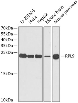 RPL9 Polyclonal Antibody