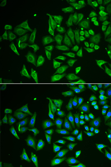 CLEC3B/Tetranectin Polyclonal Antibody
