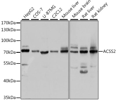 ACSS2 Polyclonal Antibody&nbsp;<img src="images/icon_newarrival.gif" alt="new" border="0">