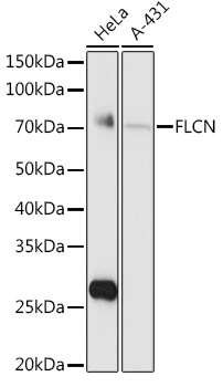 FLCN Polyclonal Antibody