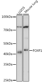 FOXF1 Monoclonal Antibody [8F6G3]