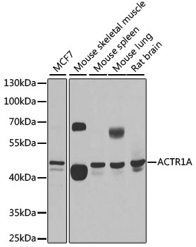 ACTR1A Polyclonal Antibody&nbsp;<img src="images/icon_newarrival.gif" alt="new" border="0">