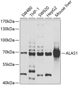 ALAS1 Polyclonal Antibody