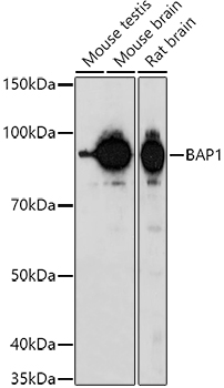 BAP1 Polyclonal Antibody