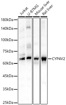CYP4V2 Polyclonal Antibody