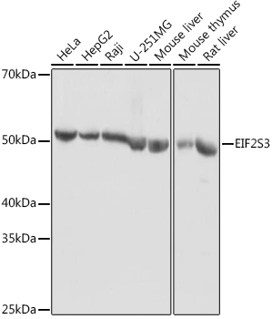 EIF2S3 Polyclonal Antibody