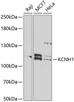 KCNH1 Polyclonal Antibody