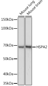 HSPA2 Monoclonal Antibody [5C9X0]