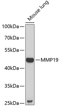 MMP19 Polyclonal Antibody