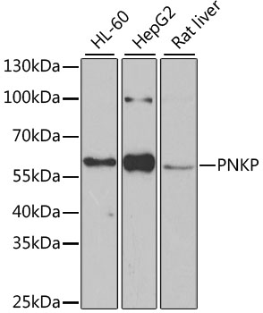 PNKP Polyclonal Antibody
