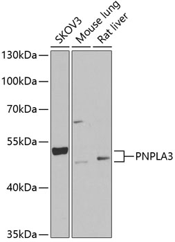 PNPLA3 Polyclonal Antibody